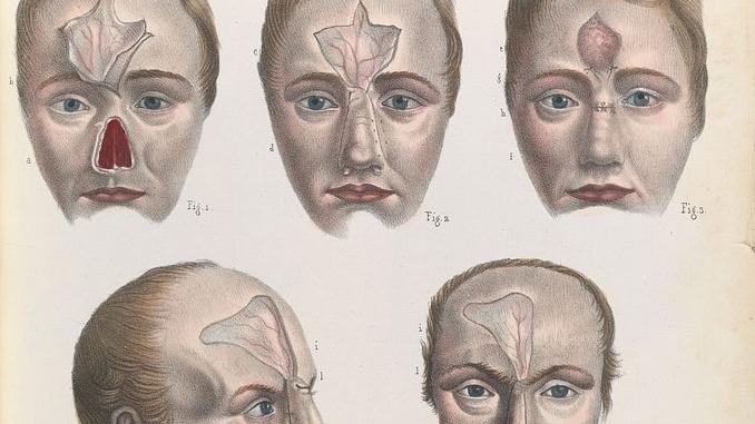 Profs & Pints Baltimore: The History of Plastic Surgery